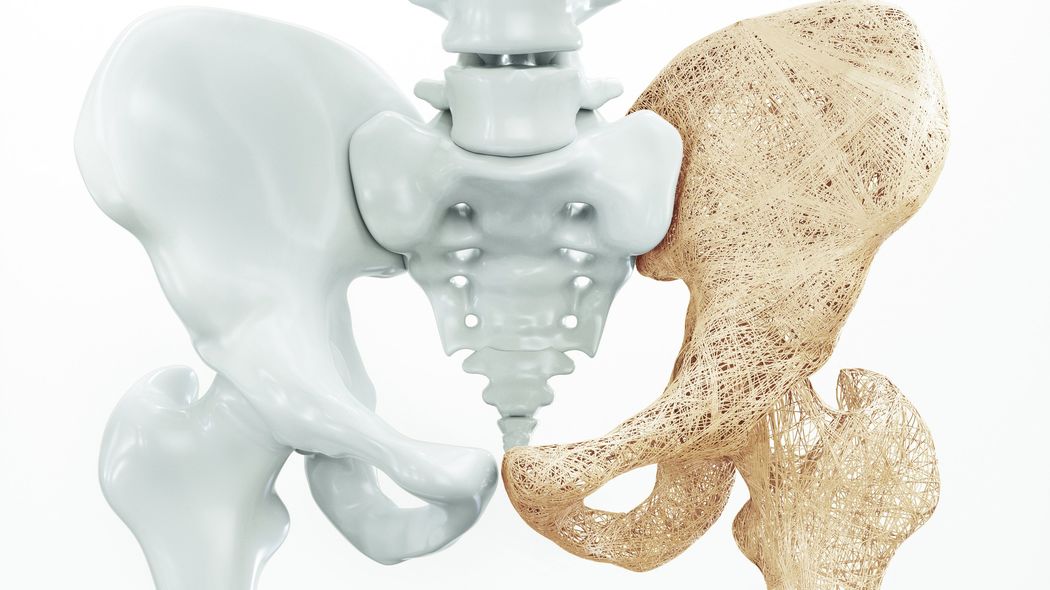 現代は40代から骨をじわじわ劣化させる完璧な条件が揃っている…医師が警鐘｢骨粗鬆症が男性に増えたワケ｣ ｢ふつうにやっちゃってる｣生活習慣で骨が老けて､もろくなる