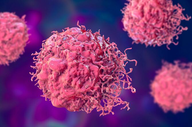 がん細胞のイメージ