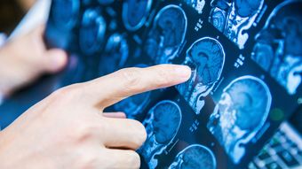 脳のピークは20代でも30代でもない…100歳のMRI画像を見た脳内科医｢80歳を超えて脳が成長する人の共通点｣