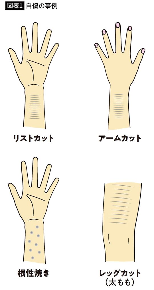 【図表1】自傷の事例