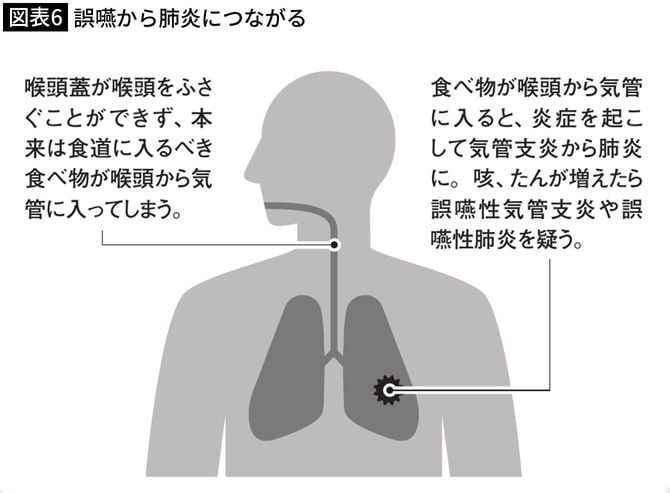 【図表6】誤嚥から肺炎につながる