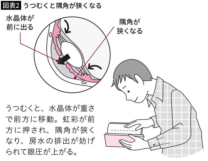 【図表2】うつむくと隅角が狭くなる