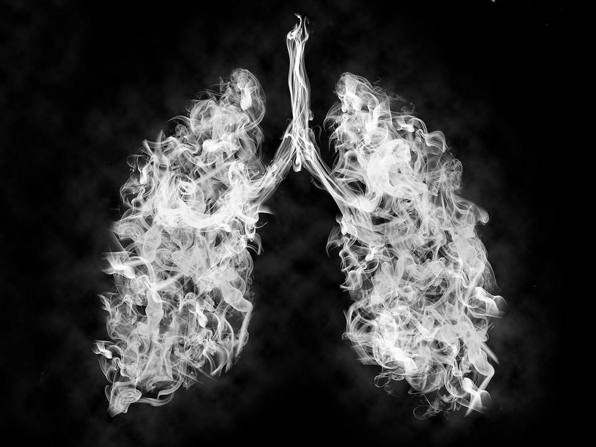 肺の有毒煙のイラスト.がんまたは病気の概念