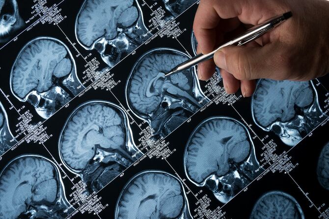 MRI 脳スキャンの頭とスカル、指を指す手