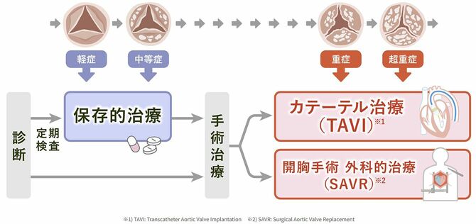 手術治療