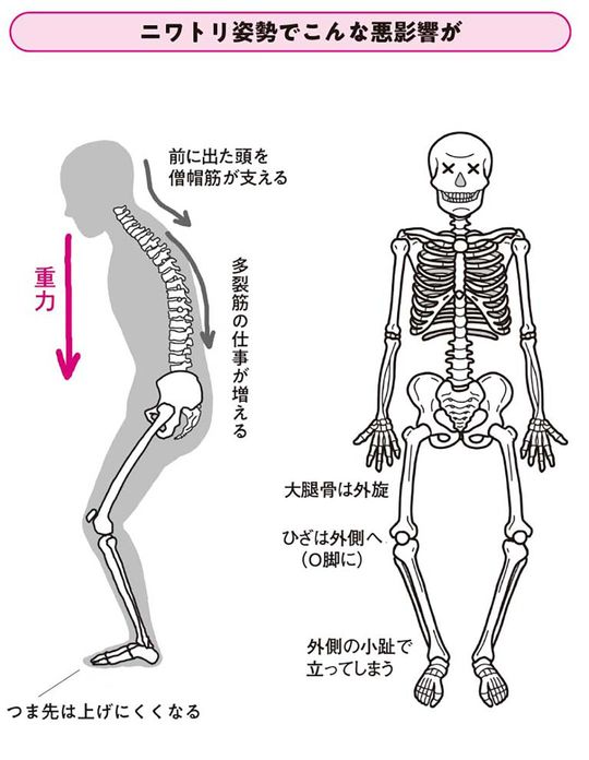 【イラスト】ニワトリ姿勢でこんな悪影響が
