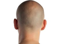 高校の運動部で"丸刈り"が増えているワケ