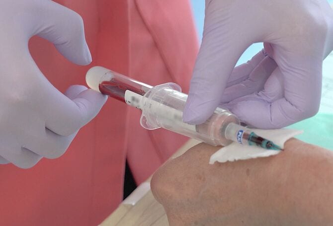 血液検査のための採血