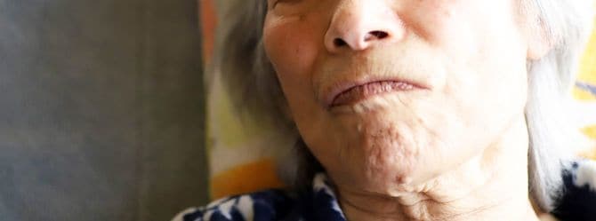 ベッドに横たわるシニア女性