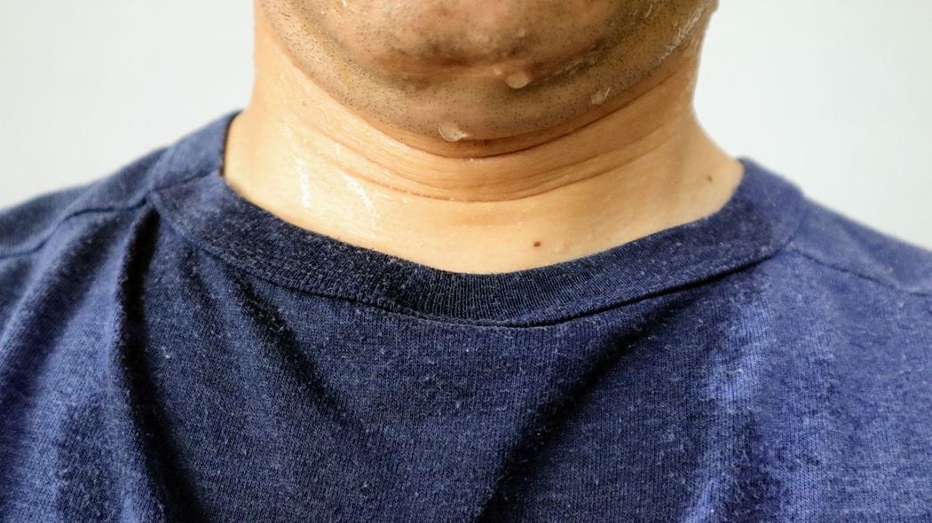 首よりも脇よりも効果的…熱中症研究者が｢暑いときは真っ先にここを冷やせ｣という意外な体の部位