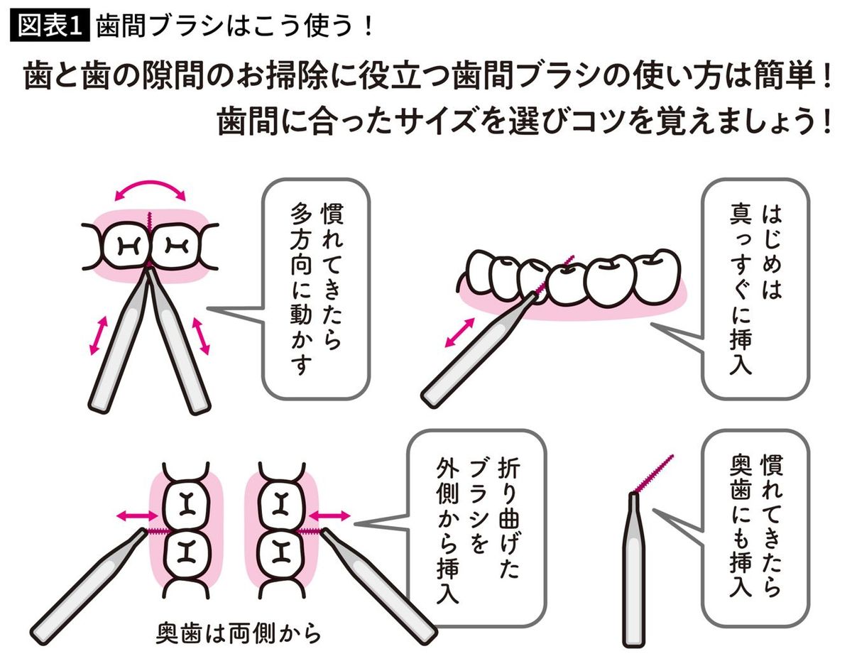 歯間ブラシはこう使う！