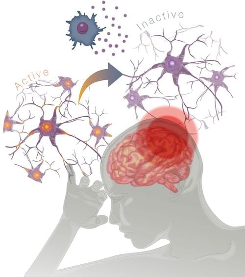 うつ病のイラスト