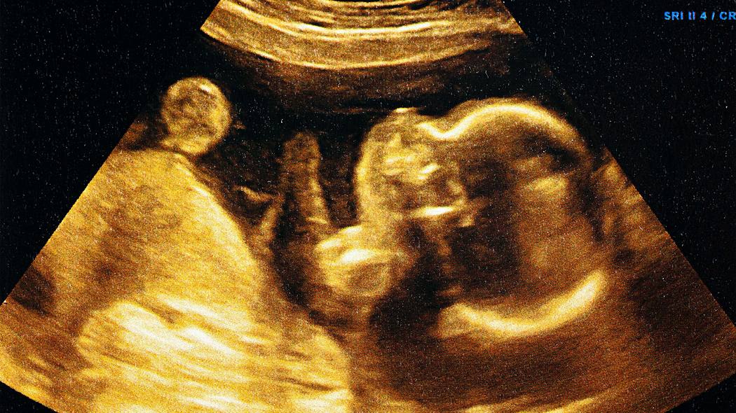 ｢いらないから堕ろしたいなら堕ろして｣待望の第2子懐妊も不倫発覚の不肖夫から離婚と中絶迫られる修羅場 毒母との縁切りで疲弊した女性に追い打ちかけた金にも女にもだらしない夫