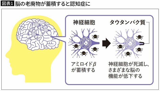 【図表1】脳の老廃物が蓄積すると認知症に