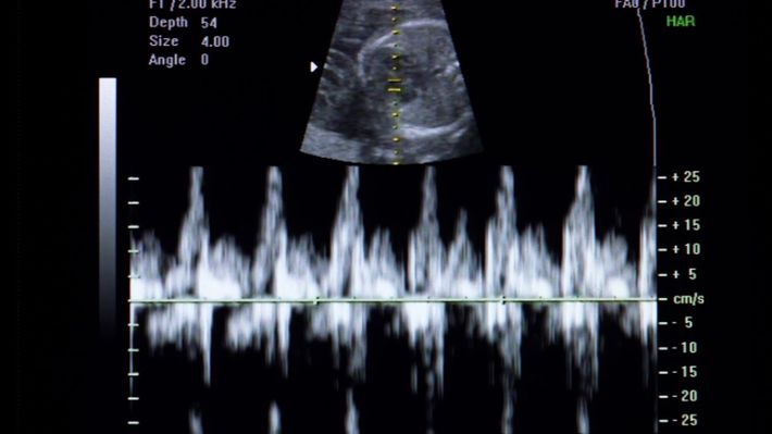 ※写真はイメージです