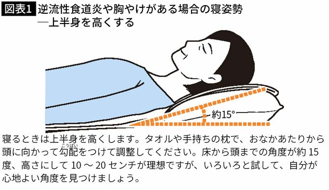 逆流性食道炎や胸やけがある場合の寝姿勢