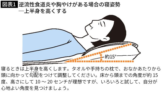 逆流性食道炎や胸やけがある場合の寝姿勢