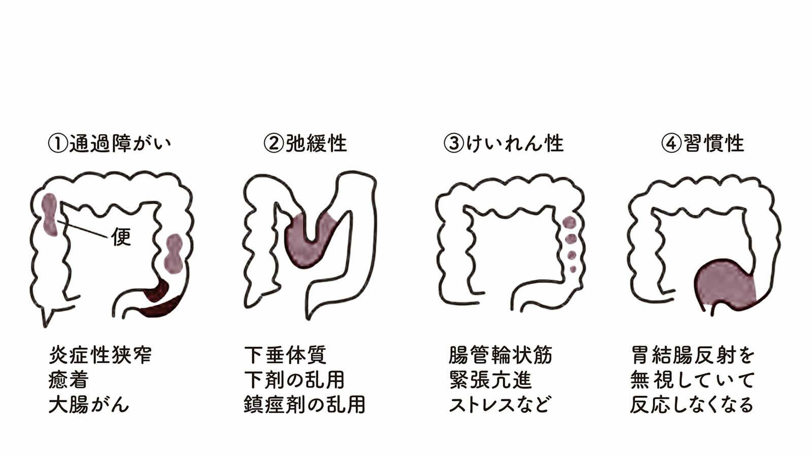 ｢便はトコロテンのようには出てこない｣慶應女子高の保健の授業で教えた"便秘と下痢のメカニズム" 通勤､通学時間が長い人に便秘が多くなりがちな理由