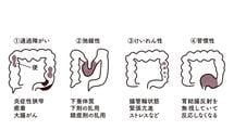｢便はトコロテンのようには出てこない｣慶應女子高の保健の授業で教えた"便秘と下痢のメカニズム"