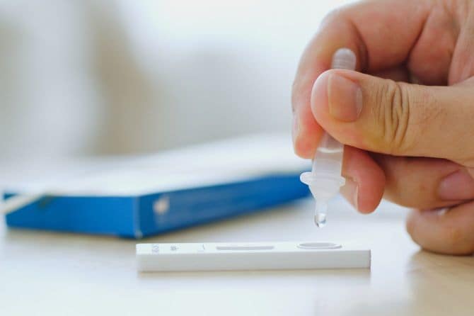 高原検査キットを使用している手元