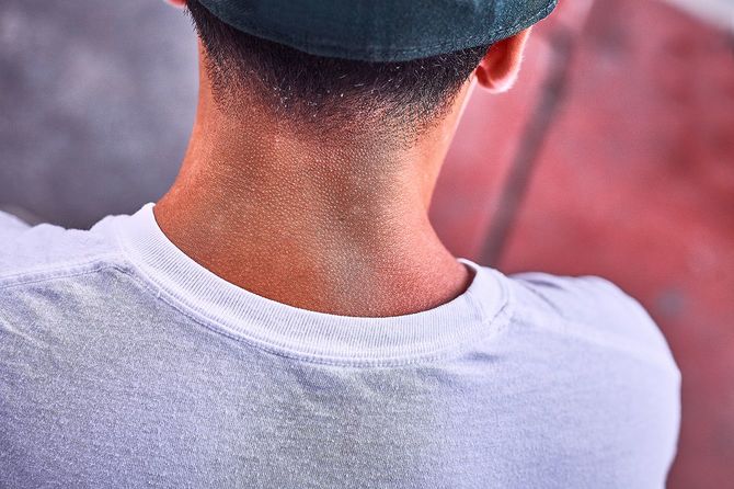 「レッドネック」を恥じる必要はない（※写真はイメージです）