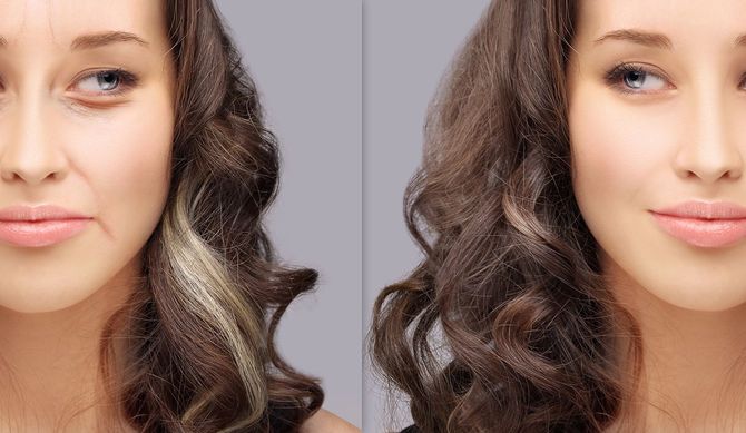 肌の問題を抱えた顔