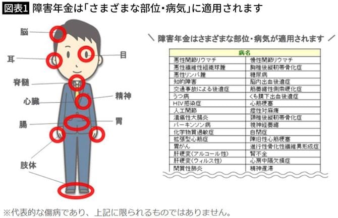 【図表1】障害年金は「さまざまな部位・病気」に適用されます