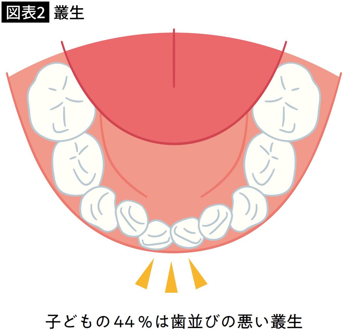 【図表2】叢生