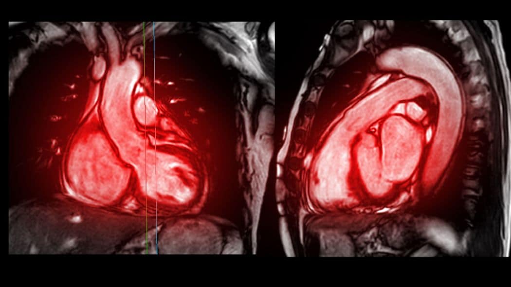 血液成分ほぼなし…認知症+透析+精神疾患の70代母を18歳から看る身重+仕事+ワンオペ娘の"極限境地" 24時間鬼電で20年間ベッタリと絡みつく毒母