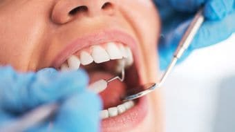 どんな時でも､世界のリーダーたちが3カ月に1度歯医者へ通う理由