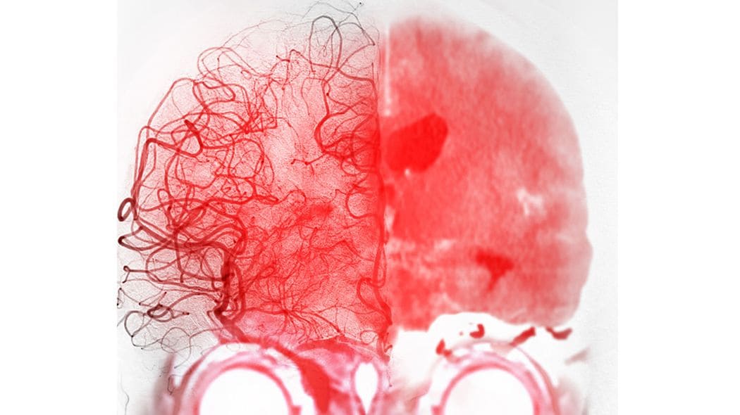 インフル･コロナより"深刻な病気"…最悪､年末年始に命を落とす人が暮らす家の特徴と正月に口にする食べ物