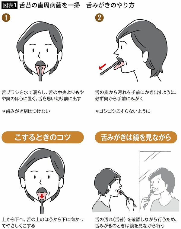 【図表1】舌苔の歯周病菌を一掃　舌みがきのやり方