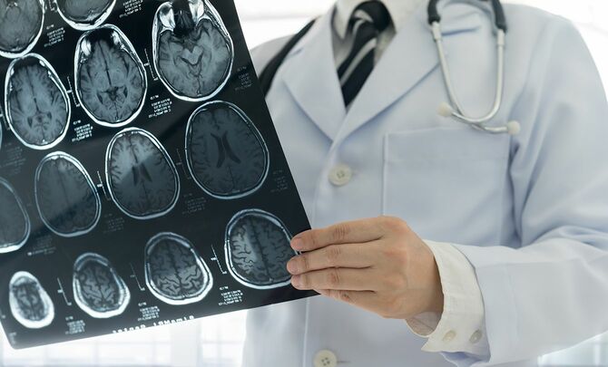 医師は、患者室病院でmriまたはctスキャン脳によって脳のX線フィルムをチェックする。医療の概念。