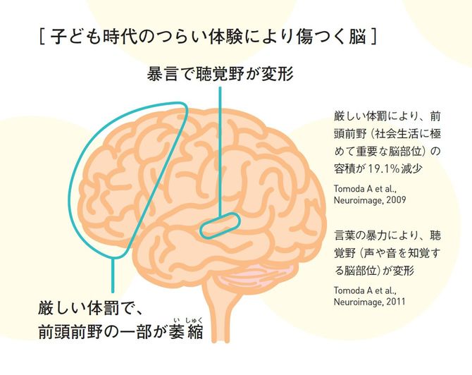 【図表】子供時代のつらい体験により傷つく脳