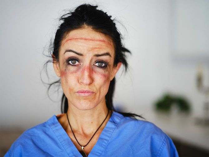 疲労した医療従事者