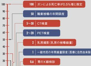 放射能汚染は、原発事故よりCT検査が危ない