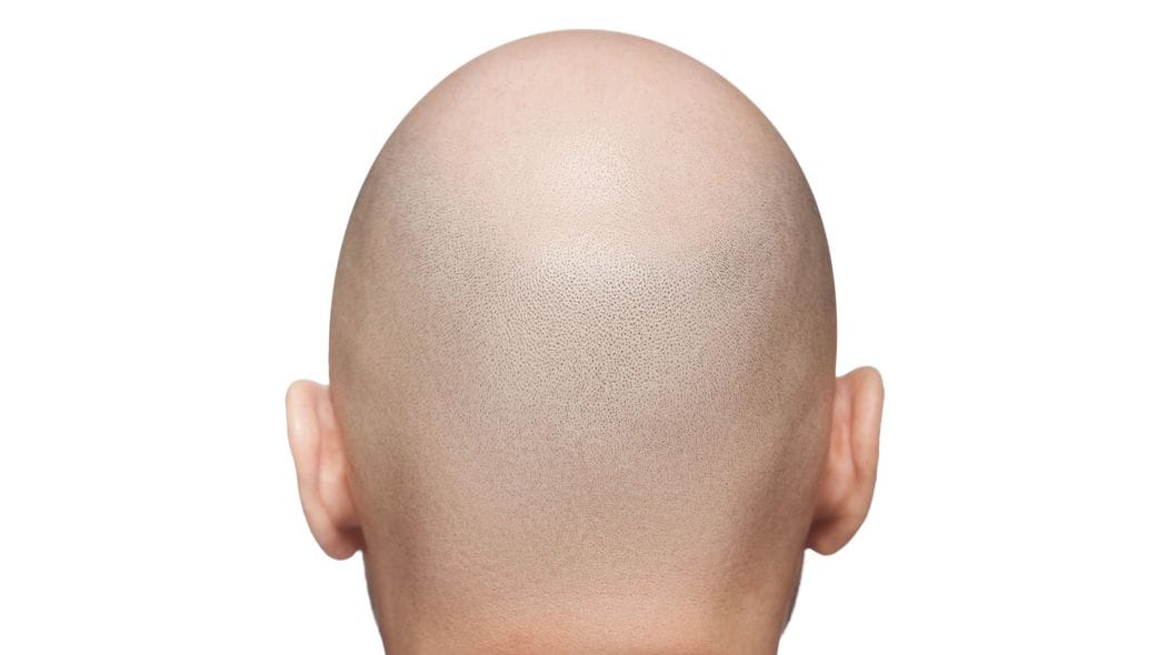 強制ではないのに､なぜ｢丸刈り｣が残り続けるのか…高校球児と仏教界の"頭髪問題"の意外な共通点 今こそ知っておきたい"頭髪"にまつわるブッダの教え