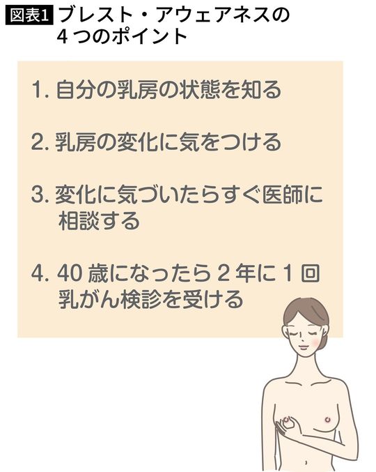 【図表】ブレスト・アウェアネスの4つのポイント