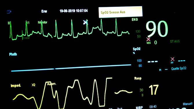 高血圧と高い心拍数と不規則な呼吸を伴う心電図