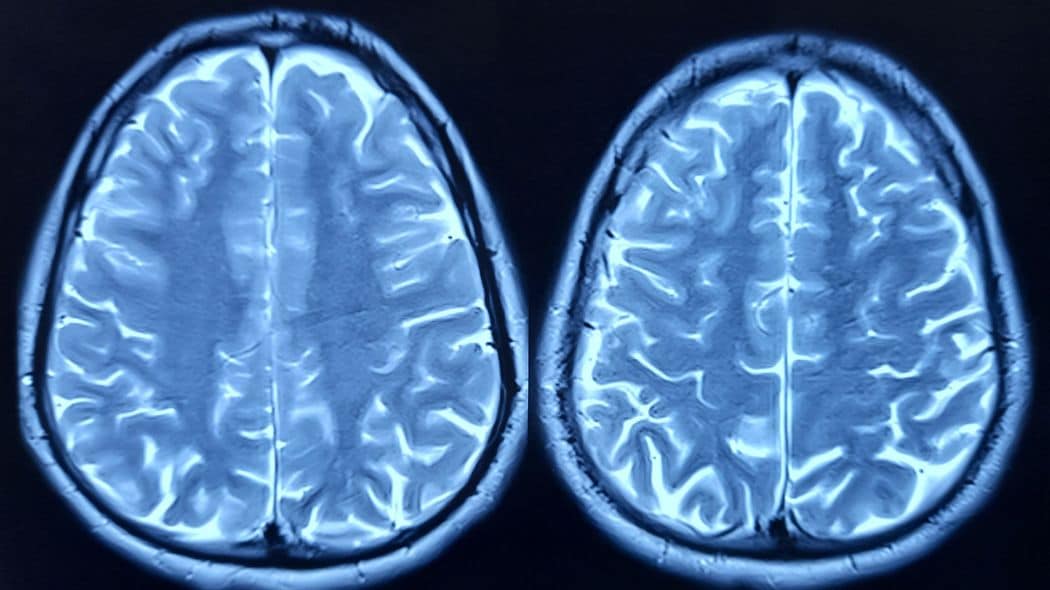 ｢玉ねぎが重くて持てない｣から始まった…肝っ玉母さんが42歳で脳梗塞､半身不随で20歳娘の"30年介護"の粛々 仕事を辞め交際していた5歳上の男性とも別れることに