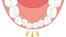 歯の矯正は10歳までに9割決まる…子供の一生を左右する｢上顎｣の成長に欠かせない"舌の位置"