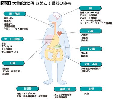 【裁断済み】　新アルコール・薬物使用障害の診断治療ガイドライン 新アルコール・薬物使用障害の診断治療ガイドライン(中古品) がん薬物