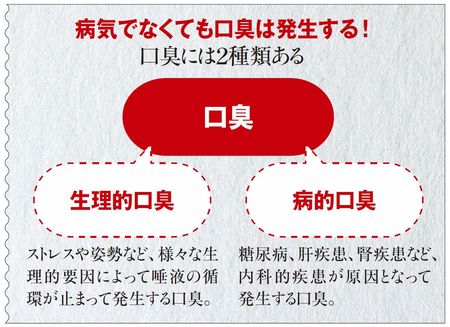 病気でなくても口臭は発生する!口臭には2種類ある