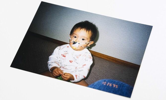 第2子の息子が小さかったとき、くわえていたおしゃぶりを落としてしまうことを不便に感じて福井さんが発明した「モーモーおしゃぶり」