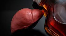 日本人の3人に1人は｢肝臓がフォアグラ状態｣…お酒好きな人ほどリスクが高まる"脂肪肝"の怖いリスク