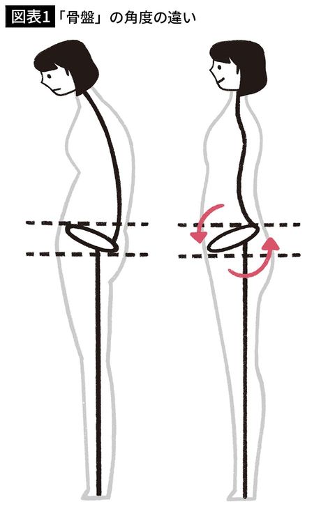 【図表1】「骨盤」の角度の違い