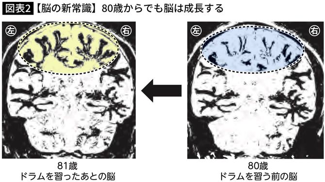 【脳の新常識】80歳からでも脳は成長する