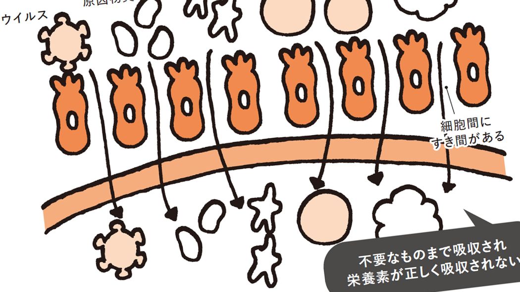 便秘･下痢が続いている人は要注意…食べても食べても栄養がムダになる｢腸漏れ｣を放置してはいけない ｢栄養不足→免疫低下→心身の不調｣という悪循環