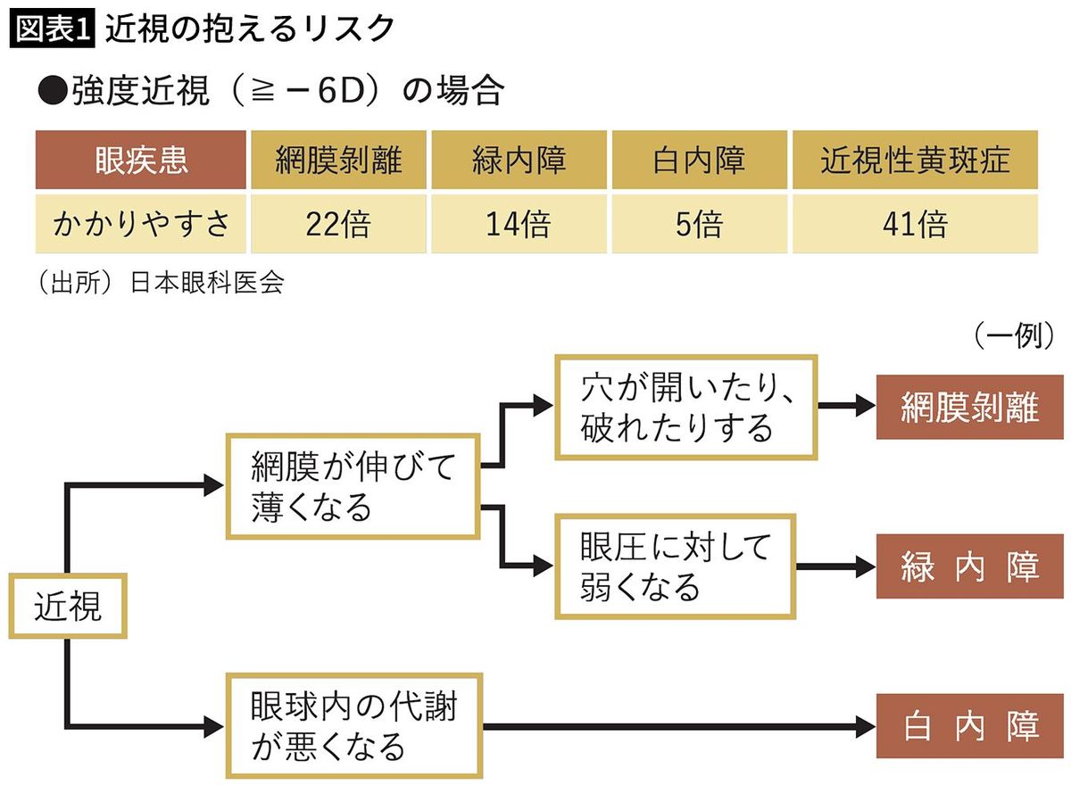 【図表1】近視の抱えるリスク