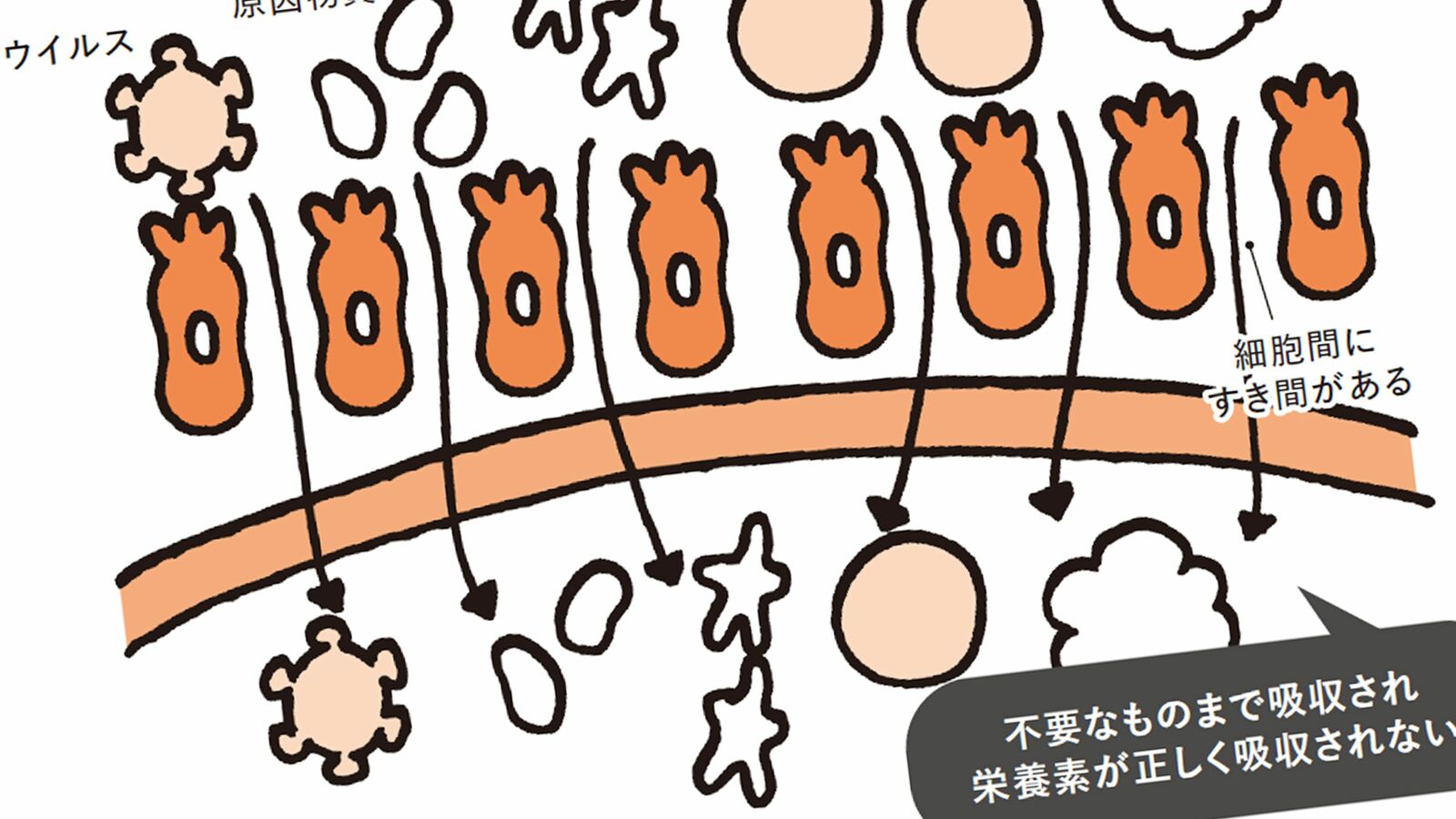 便秘･下痢が続いている人は要注意…食べても食べても栄養がムダになる｢腸漏れ｣を放置してはいけない ｢栄養不足→免疫低下→心身の不調｣という悪循環